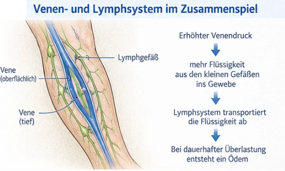 Zusammenhang zwischen erhöhtem Venendruck,
 Flüssigkeitsansammlung im Gewebe und Lymphabfluss